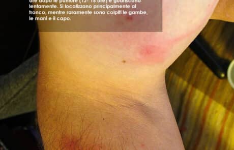 Identificare le punture dell'acaro dei tarli