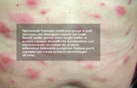 Identificare le punture dell'acaro dei tarli