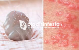 Sintomi punture acaro della malattia scabbia Sintomi punture acaro della malattia scabbia