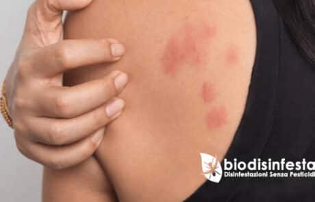 Punture pulci come riconoscere l'infestazione in casa