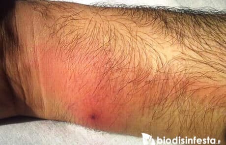 Caratteristiche punture zecche del piccione Caratteristiche punture zecche del piccione