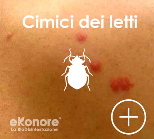 Riconoscere le punture delle cimici dei letti