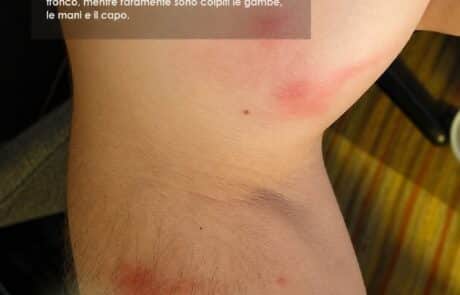disinfestazione acaro del tarlo