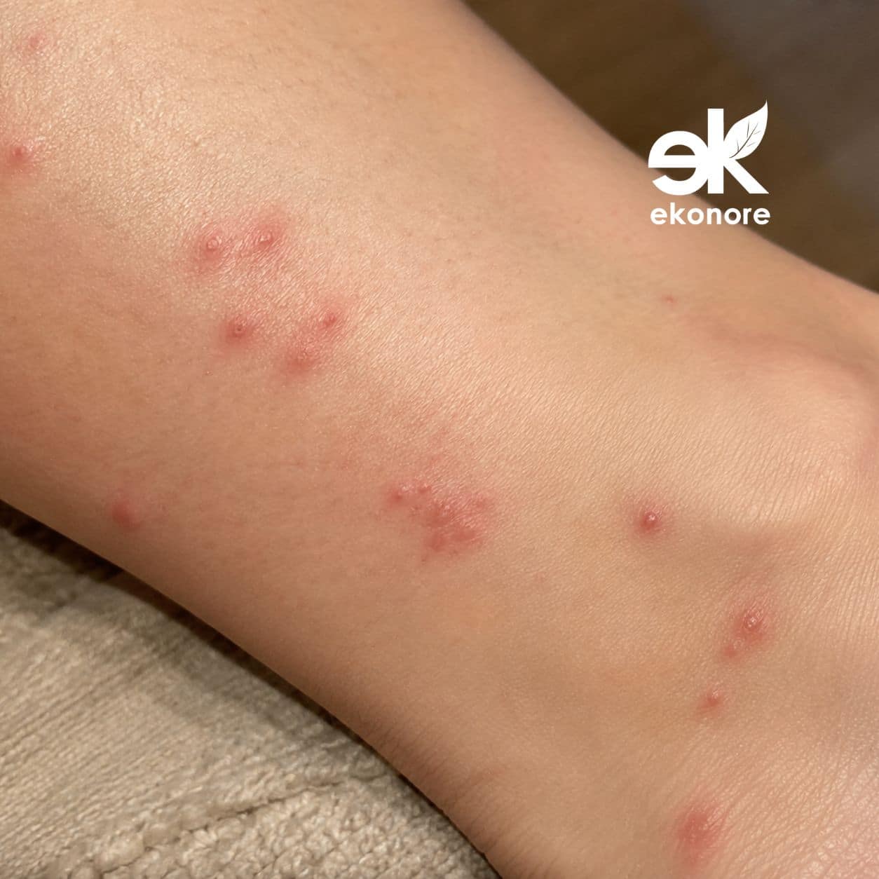 punture scleroderma domesticus disinfestazione Punture Scleroderma Domesticus